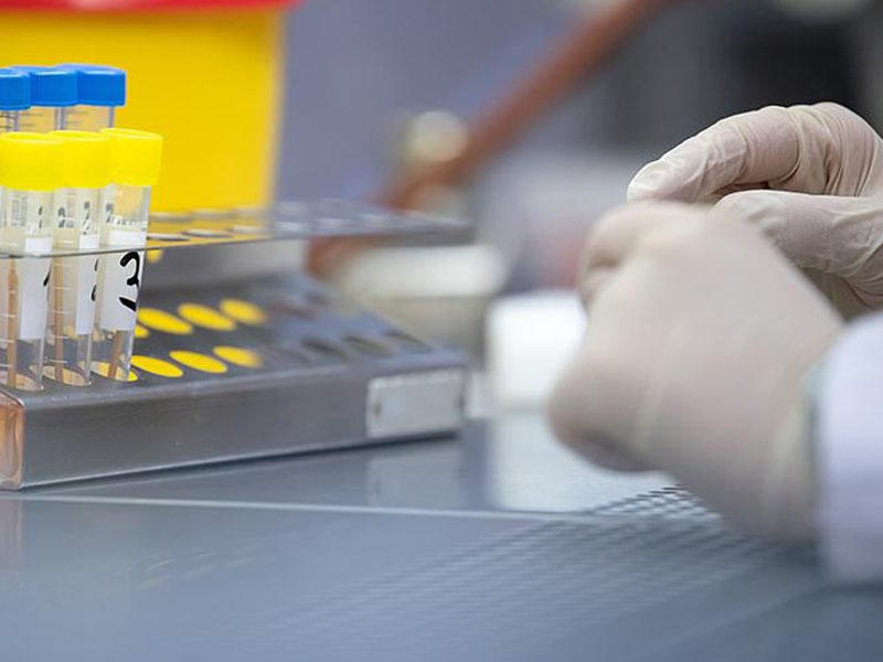 "Spartak"ın sahibi COVİD-19-a yoluxdu