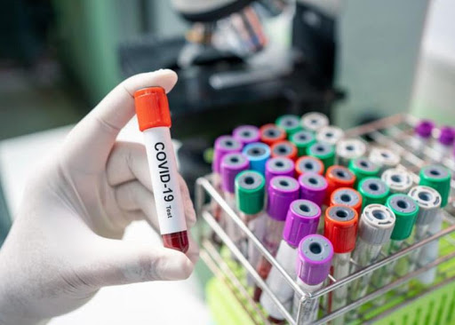 Səudiyyə Ərəbistanın​ liqasında kütləvi yoluxma halı