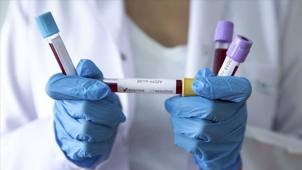 Azərbaycanda koronavirusa daha 4170 yeni yoluxma halı aşkarlandı