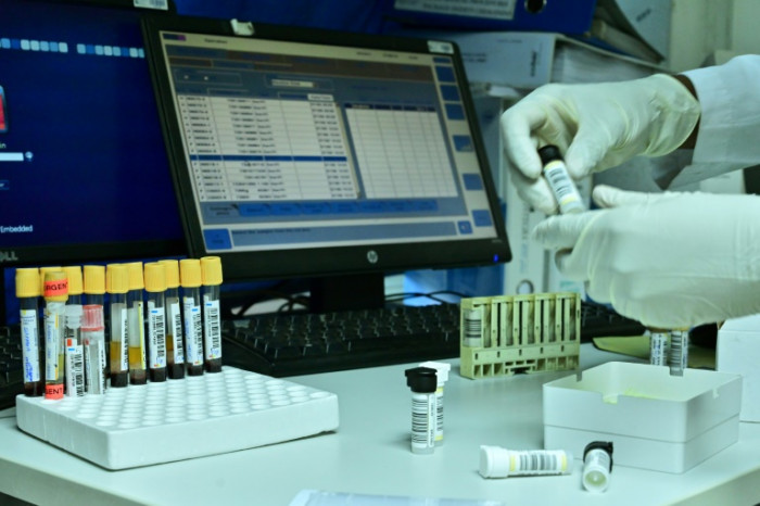 AMADA koronavirus peyvəndi ilə bağlı məlumat verdi